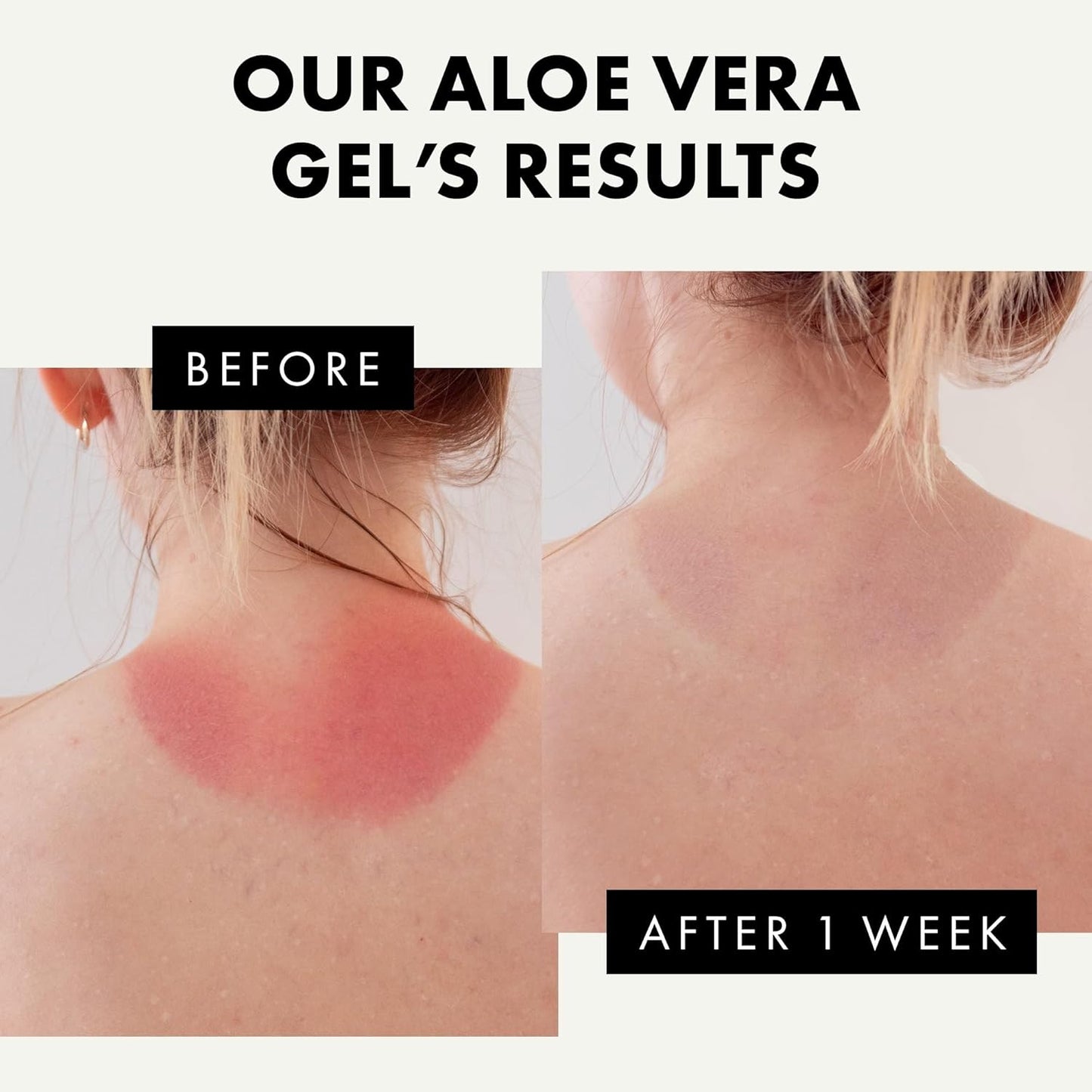 2 X 100ml Eclat Aloe Vera Gel safely soothes and Moisturizers Natural Organic